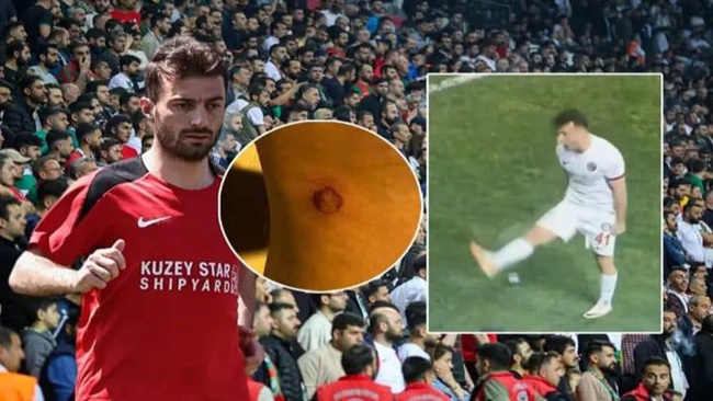 BURAK SÜLEYMAN PFDK'DA!