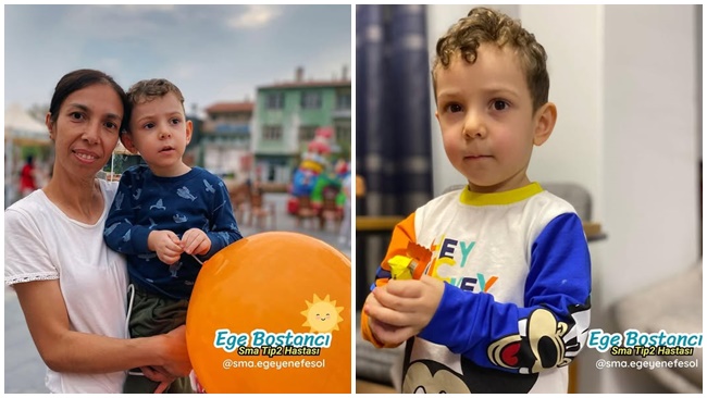 ÇORUMLU SMA HASTASI MİNİK  EGE YARDIMLARINIZI BEKLİYOR